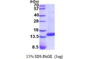 SDS-PAGE (SDS) image for Cystatin D (CST5) (AA 26-142) (Active) protein (His tag) (ABIN5854281)