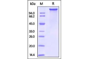 Mouse LDL R, His Tag on SDS-PAGE under reducing (R) condition. (LDLR Protein (AA 22-790) (His tag))
