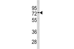 Western blot analysis of CEA antibody and 293 lysate (CEA antibody  (AA 400-429))