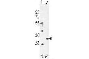Western blot analysis of PRDX4 (arrow) using rabbit polyclonal PRDX4 Antibody (Center) . (Peroxiredoxin 4 antibody  (Middle Region))
