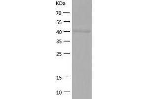 Western Blotting (WB) image for Glutaryl-CoA Dehydrogenase (GCDH) (AA 45-438) protein (His tag) (ABIN7123126) (GCDH Protein (AA 45-438) (His tag))