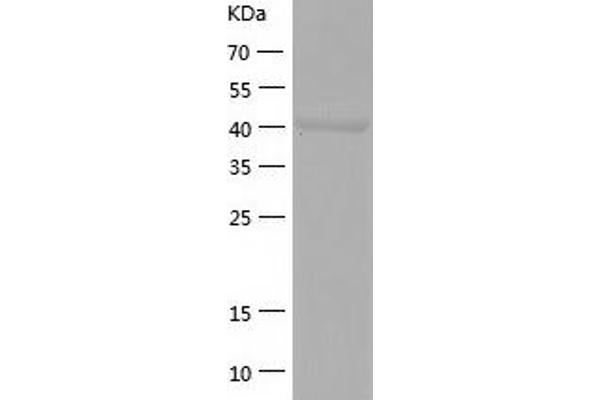 GCDH Protein (AA 45-438) (His tag)