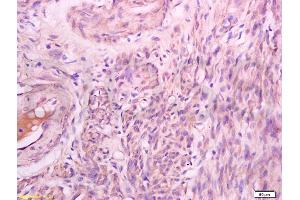 Immunohistochemistry (IHC) image for anti-Talin (TLN) (pSer425) antibody (ABIN703135)