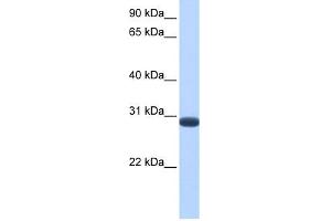 WB Suggested Anti-DUSP19 Antibody Titration: 0. (DUSP19 antibody  (C-Term))