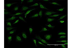 Immunofluorescence of purified MaxPab antibody to UBL7 on HeLa cell. (UBL7 antibody  (AA 1-380))