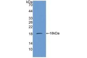 Detection of Recombinant SDHD, Mouse using Polyclonal Antibody to Succinate Dehydrogenase Complex Subunit D (SDHD) (SDHD antibody  (AA 1-159))