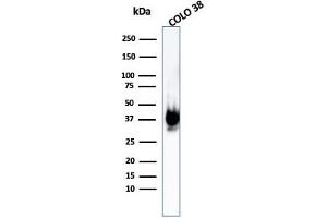 Western Blot Analysis of COLO-38 cell lysate using gp100 Rabbit Recombinant Monoclonal Antibody (PMEL/1825R). (Recombinant Melanoma gp100 antibody)
