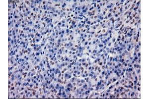 Immunohistochemical staining of paraffin-embedded lung using anti-EpCAM (ABIN2452677) mouse monoclonal antibody. (EpCAM antibody  (AA 24-265))