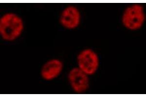 ABIN6274710 staining 293 cells by IF/ICC. (EFTUD2 antibody)