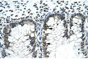 Immunohistochemistry (IHC) image for anti-GLI Family Zinc Finger 2 (GLI2) (Middle Region) antibody (ABIN2777474)