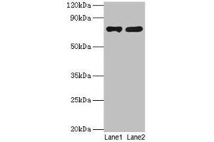 Western blot All lanes: PARN antibody at 2 μg/mL Lane 1: Jurkat whole cell lysate Lane 2: A431 whole cell lysate Secondary Goat polyclonal to rabbit IgG at 1/10000 dilution Predicted band size: 74, 67, 68, 53 kDa Observed band size: 74 kDa (PARN antibody  (AA 1-639))