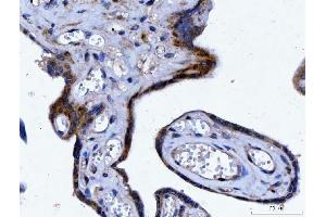 IHC analysis of YWHAE using anti-YWHAE antibody (ABIN7599165). (YWHAE antibody  (AA 1-255))