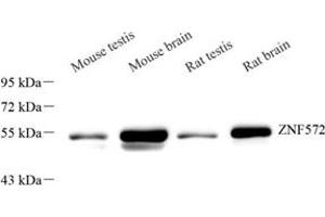 Western blot analysis of ZNF572 (ABIN7076268) at dilution of 1: 2000 (ZNF572 antibody)