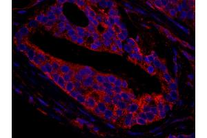 Immunofluorescence (IF) image for anti-CCR4-NOT Transcription Complex, Subunit 3 (CNOT3) (AA 525-575) antibody (ABIN7448941)