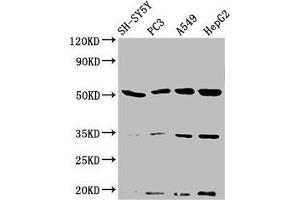 Western Blot Positive WB detected in: SH-SY5Y whole cell lysate, PC-3 whole cell lysate, A549 whole cell lysate, HepG2 whole cell lysate All lanes: NAGPA antibody at 3. (NAGPA antibody  (AA 327-438))