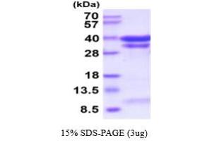 SDS-PAGE (SDS) image for Cathepsin B (CTSB) (AA 18-339) (Active) protein (His tag) (ABIN6387936) (Cathepsin B Protein (CTSB) (AA 18-339) (His tag))