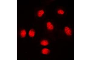 Immunofluorescent analysis of RUNX1 staining in THP1 cells. (RUNX1 antibody  (Center))