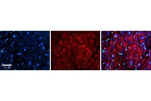Rabbit Anti-S100A8 Antibody Catalog Number: ARP61367_P050 Formalin Fixed Paraffin Embedded Tissue: Human heart Tissue Observed Staining: Secreted Primary Antibody Concentration: 1:100 Other Working Concentrations: 1:600 Secondary Antibody: Donkey anti-Rabbit-Cy3 Secondary Antibody Concentration: 1:200 Magnification: 20X Exposure Time: 0. (S100A8 antibody  (Middle Region))