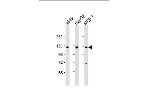 All lanes : Anti-KLB Antibody (N-Term) at 1:2000 dilution Lane 1: A549 whole cell lysate Lane 2: HepG2 whole cell lysate Lane 3: MCF-7 whole cell lysate Lysates/proteins at 20 μg per lane. (Klotho beta antibody  (AA 1-29))
