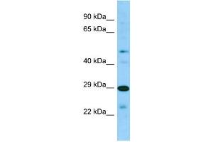 Host: Rabbit Target Name: SIRPB2 Sample Type: 721_B Whole Cell lysates Antibody Dilution: 1. (SIRPb2 antibody  (C-Term))