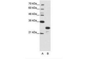 Image no. 2 for anti-Acidic (Leucine-Rich) Nuclear phosphoprotein 32 Family, Member A (ANP32A) (N-Term) antibody (ABIN202122) (PHAP1 antibody  (N-Term))