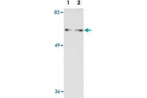 Western blot analysis of SHOC2 in Jurkat cell lysate with SHOC2 polyclonal antibody  at (A) 1 and (B) 2 ug/mL . (SHoc2/Sur8 antibody  (N-Term))
