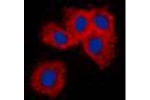 Immunofluorescent analysis of Vimentin staining in A549 cells. (Vimentin antibody  (N-Term))