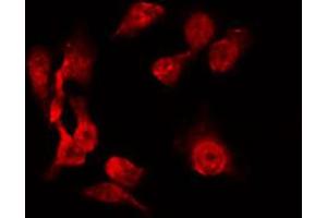 ABIN6267228 staining 293 by IF/ICC. (Aurora A antibody  (pThr288))