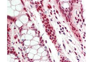 Immunohistochemistry (IHC) image for anti-Acidic (Leucine-Rich) Nuclear phosphoprotein 32 Family, Member A (ANP32A) (AA 121-170) antibody (ABIN1923417)