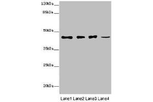 Western blot All lanes: SIRPB1 antibody at 6 μg/mL Lane 1: A549 whole cell lysate Lane 2: PC-3 whole cell lysate Lane 3: A375 whole cell lysate Lane 4: Mouse heart tissue Secondary Goat polyclonal to rabbit IgG at 1/10000 dilution Predicted band size: 44, 20 kDa Observed band size: 44 kDa