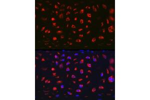 Immunofluorescence analysis of Rat cartilage using MGP Rabbit pAb (ABIN6128268, ABIN6143825, ABIN6143826 and ABIN6221090) at dilution of 1:100 (40x lens). (MGP antibody  (AA 20-103))