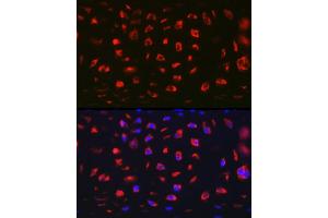Immunofluorescence analysis of Rat cartilage using MGP Rabbit pAb (ABIN6128268, ABIN6143825, ABIN6143826 and ABIN6221090) at dilution of 1:100 (40x lens). (MGP antibody  (AA 20-103))