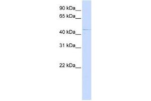 ZDHHC16 antibody used at 1 ug/ml to detect target protein. (ZDHHC16 antibody  (C-Term))