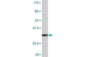 Western Blot detection against Immunogen (36. (STK16 antibody  (AA 1-100))