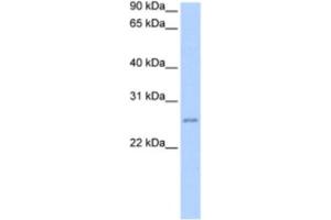Western Blotting (WB) image for anti-Chromosome 8 Open Reading Frame 84 (C8orf84) antibody (ABIN2463542) (RPESP antibody)