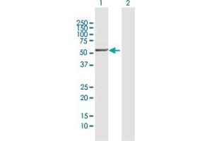 Western Blot analysis of PTGIS expression in transfected 293T cell line by PTGIS MaxPab polyclonal antibody. (PTGIS antibody  (AA 1-500))