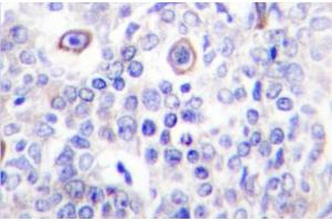 Image no. 2 for anti-CD83 (CD83) antibody (ABIN272283) (CD83 antibody)