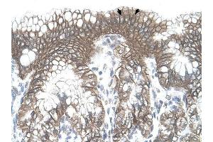 TARS antibody was used for immunohistochemistry at a concentration of 4-8 ug/ml to stain Epithelial cells of fundic gland (arrows) in Human Stomach. (TARS antibody  (N-Term))
