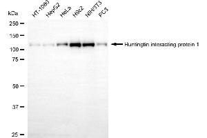 Western blotting analysis using huntingtin interacting protein 1 antibody (ABIN7799006).