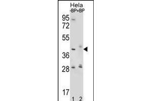 Western blot analysis of HYAL2 Antibody (Center) Pab (ABIN656422 and ABIN2845714) pre-incubated without(lane 1) and with(lane 2) blocking peptide in Hela cell line lysate.
