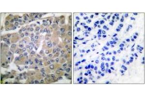 Immunohistochemistry (IHC) image for anti-Matrix Metallopeptidase 8 (Neutrophil Collagenase) (MMP8) (AA 418-467) antibody (ABIN1533354)