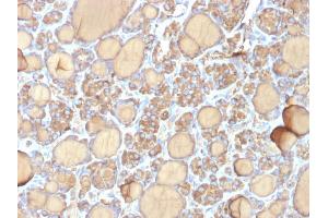 Formalin-fixed, paraffin-embedded human Thyroid stained with Thyroglobulin Mouse Recombinant Monoclonal Antibody (r6E1). (Recombinant Thyroglobulin antibody)