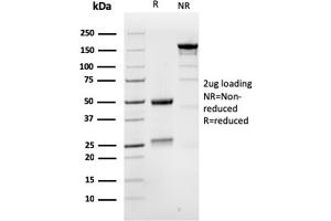 SDS-PAGE Analysis Purified MSH6 Mouse Monoclonal Antibody (MSH6/3086). (MSH6 antibody  (AA 374-540))