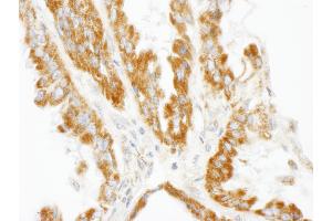 anti-CCR4-NOT Transcription Complex, Subunit 3 (CNOT3) (AA 525-575) antibody