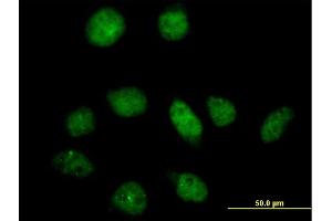 Immunofluorescence of purified MaxPab antibody to PFKFB3 on HeLa cell.