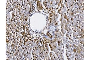 IHC analysis of Alanine Transaminase/Gpt using anti-Alanine Transaminase/Gpt antibody (ABIN7600506). (ALT antibody  (AA 2-496))