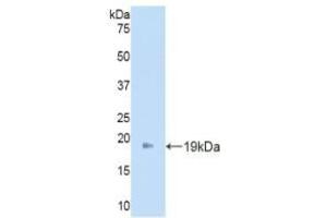 Angiopoietin 2 antibody  (AA 19-147)