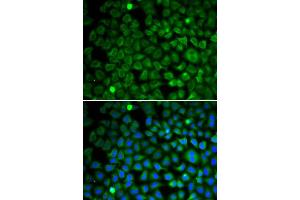 Immunofluorescence analysis of U2OS cells using NUP62 antibody (ABIN5971334). (NUP62 antibody)