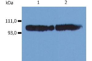 Western Blotting analysis (non-reducing conditions) of whole cell lysate using anti-human CD18 (). (Integrin beta 2 antibody  (FITC))