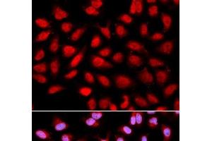 Immunofluorescence (IF) image for anti-Protein Phosphatase 2A Activator, Regulatory Subunit 4 (PPP2R4) antibody (ABIN7259933)
